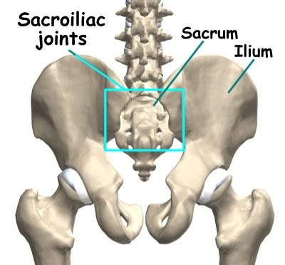 Types of Arthritis That Cause Sacroiliac Joint Pain and Their Symptoms… | Tristate Arthritis ...