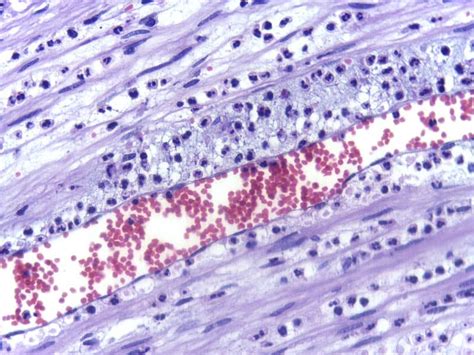 Diapedesis Histology