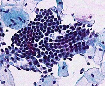 Cervical cytology - patholines.org