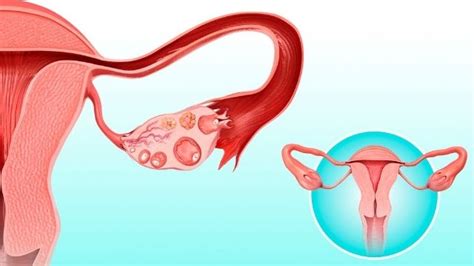 Follicular Study: Scan Purpose, Procedure, Success Rate | Shree IVF Clinic