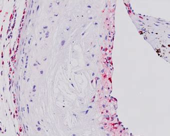 Heart Histology - Aortic sinus - histology slide