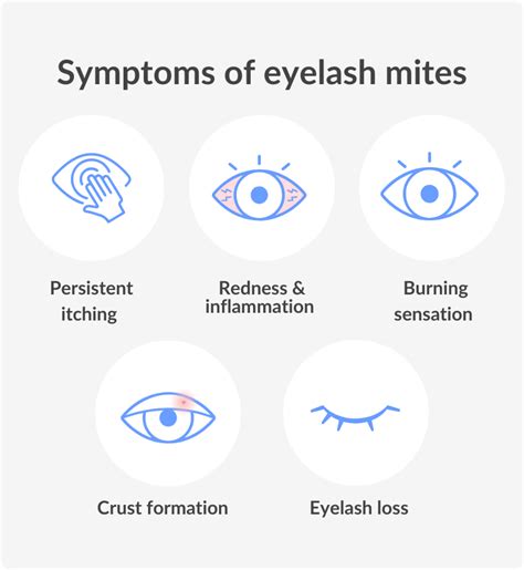 Eyelash Mites: Symptoms, Causes and Treatment | SmartBuyGlasses CA