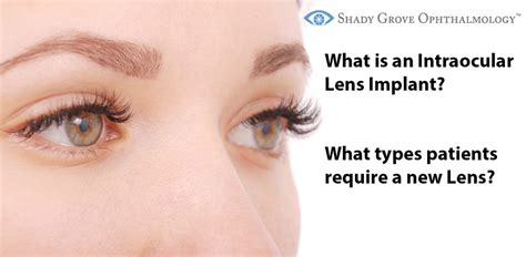 What is an Intraocular Lens Implant? What types of patients require a ...