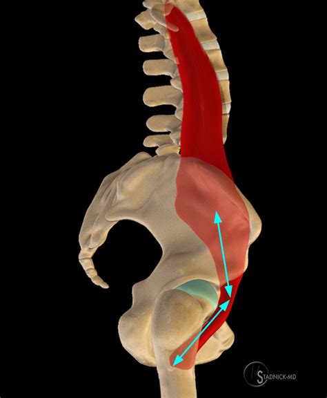 Iliopsoas Tendinopathy | Radsource