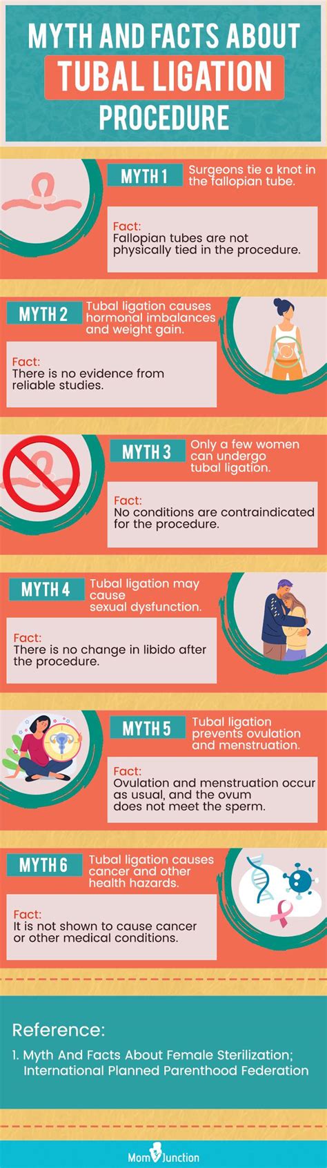 Top more than 122 falope ring tubal ligation reversal super hot - xkldase.edu.vn