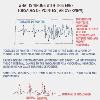 Dear Nurses: RECOGNIZING TORSADES DE POINTES