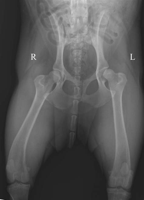 Tips & Techniques for Pelvic Radiography | Clinician's Brief