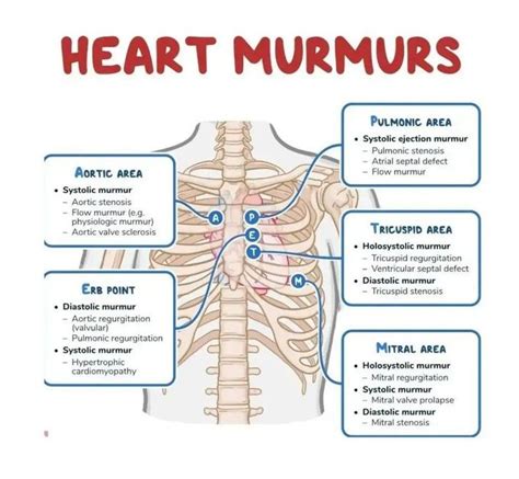 Heart Murmurs - MEDizzy