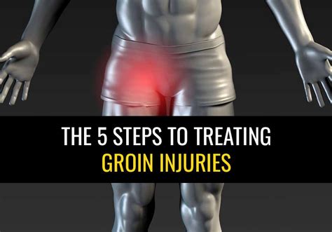 Groin Injury - Groin strain: Symptoms, treatment, and recovery | gsmflashserangbanten