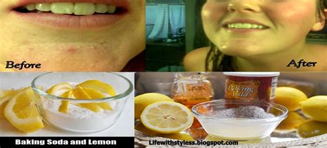 BAKING SODA & LEMON - Complete Skin Care Ingredients - DIY FACE MASK | Life With Styles