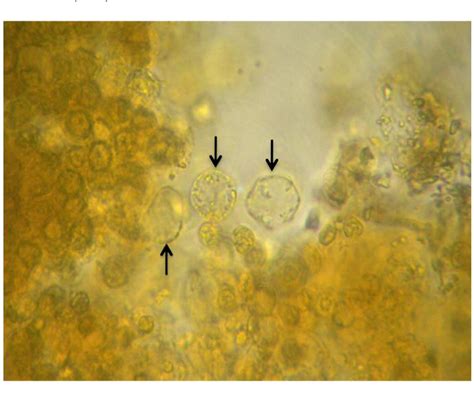 Blastocystis Hominis Life Cycle