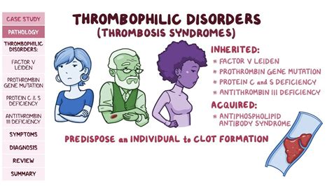 Thrombosis syndromes (hypercoagulability): Pathology review | Osmosis