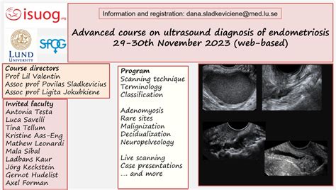 Advanced course on ultrasound examination of endometriosis and ...