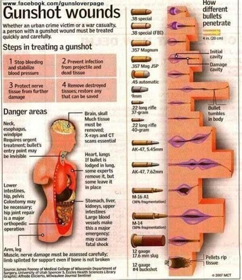 Bullet Wound Treatment