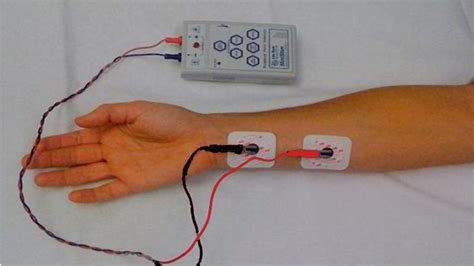 How to Perform Train of Four Monitoring — From New to ICU