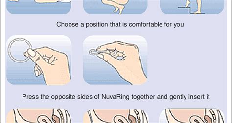 NuvaRing – a new method of contraception – Healthy Food Near Me