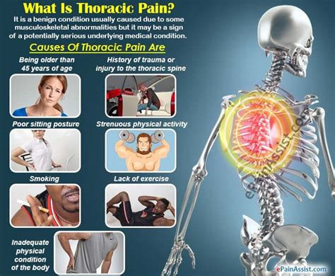 39 Awesome Can Thoracic Spine Problems Cause Chest Pain - insectza