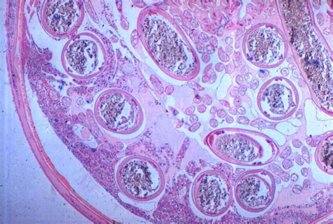 (PDF) Fig 5 Schistocerca gregaria D85-716 Nematode (Mermis nigrescens ...