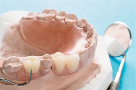 REMOVABLE DENTURES (ACRYLIC AND VALPLAST) | Schubbs Dental