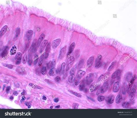 425 Trachea Histology Images, Stock Photos & Vectors | Shutterstock