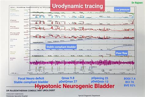 Urodynamics / Urodynamic Study - Urology Malaysia