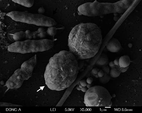 Scanning electron microscope imaging of chlamydospores converted from... | Download Scientific ...