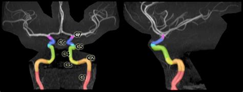 Vascular Anatomy of the Brain Review | NowYouKnow Neuro