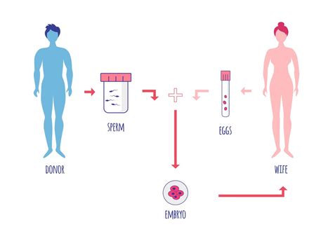 What to Expect if You Use Donor Eggs for IVF