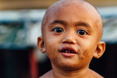 Child With Rotten Teeth, Tondo Landfill, Manila | Taken at L… | Flickr