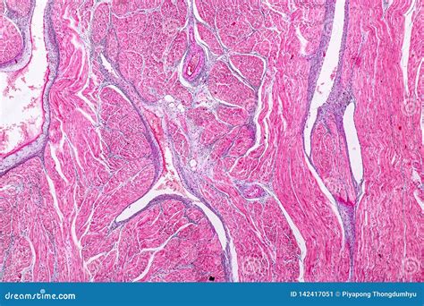 Histological Sample Heart Muscle Tissue Under the Microscope. Stock Image - Image of heart ...