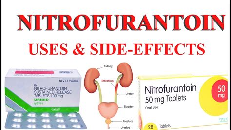 Nitrofurantoin uses/side effects - YouTube