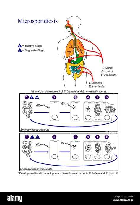 Microsporidiosis life cycle. Diagram showing the life cycle of the ...