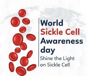 Shine the light on Sickle cell- Hydroxyurea in Sickle cell disease.