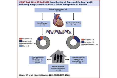 Increased genetic testing could identify concealed cardiomyopathy