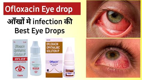 ofloxacin eye drops uses in hindi | best eye drops for dry eyes | Best ...