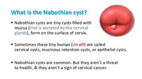 Signs Of Cervical Cancer Or Cysts - CancerWalls