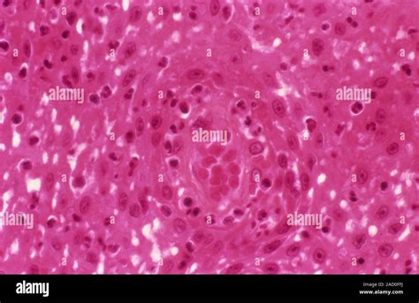 Diapedesis Histology