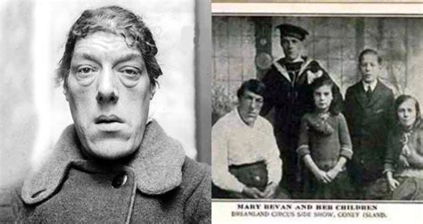 The Story Of Mary Ann Bevan, The 'Ugliest Woman In The World'