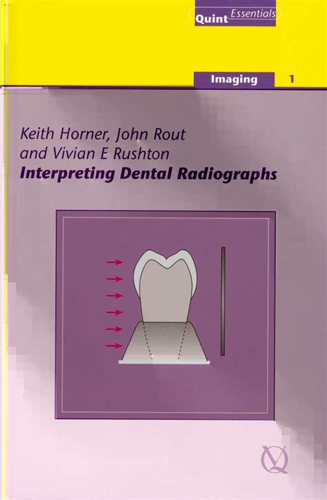 Interpreting Dental Radiographs - QuintEd