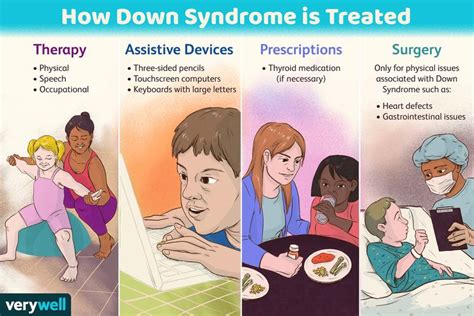 How Down Syndrome Is Treated