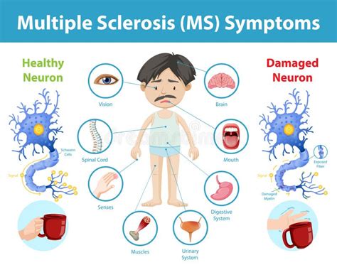 Multiple Sclerosis Symptoms Icon Stock Illustrations – 38 Multiple ...