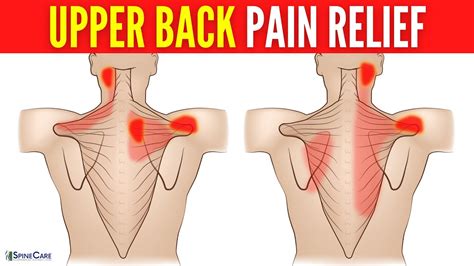 How to Fix Your Upper Back Pain | STEP-BY-STEP Guide - YouTube