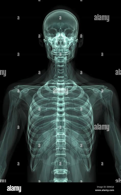 X-Ray image showing the rib cage Stock Photo - Alamy