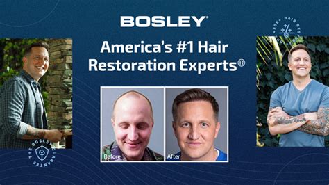 Bosley Hair Restoration Locations Near Me - Bosley Hair Transplant