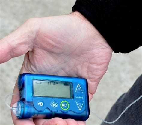 New insulin pump with control technology launched in U.S. | Healthcare ...