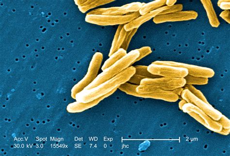 Free picture: gram, positive, mycobacteria tuberculosis, bacteria