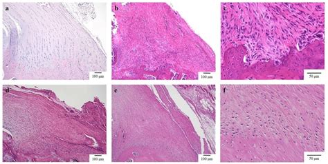 Histology of the tendon attachment site in a normal control specimen ...