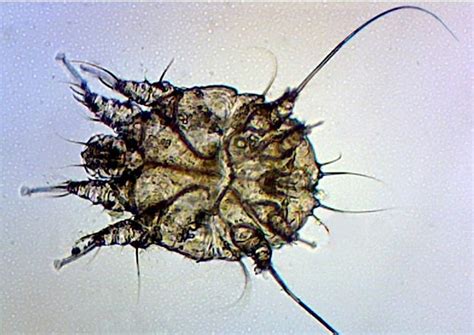 Island Urgent Care Blog: Medical Monday: How Scary is Scabies?