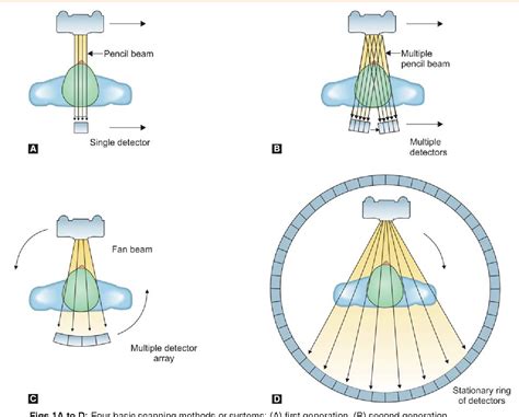 Figure 1 from Comparison of Spiral Computed Tomography and Cone-Beam Computed Tomography ...