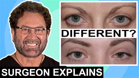 Chip Cole, MD, Discusses The Most Common Eyelid Surgery Risks & Complications